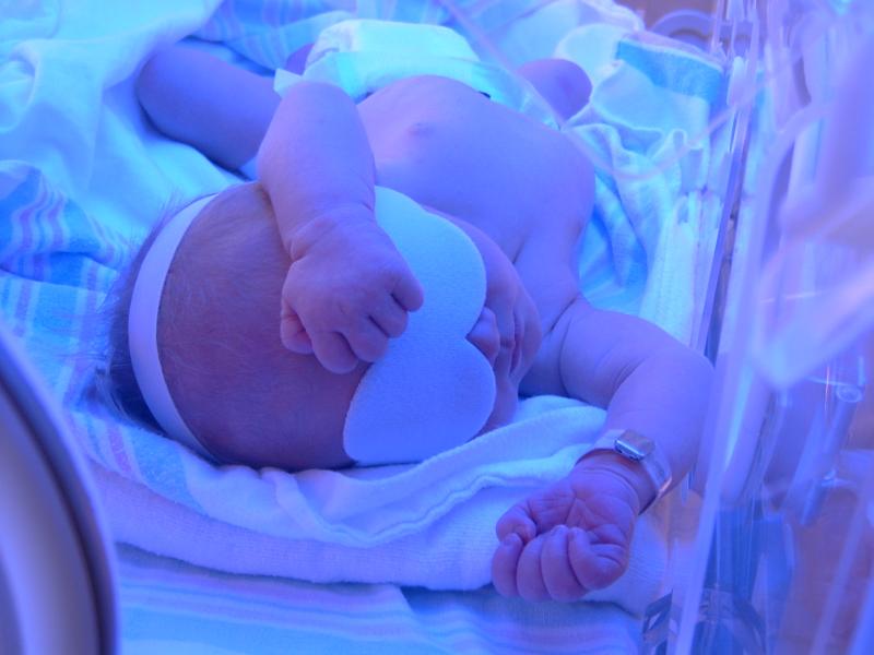  Baby in incubator