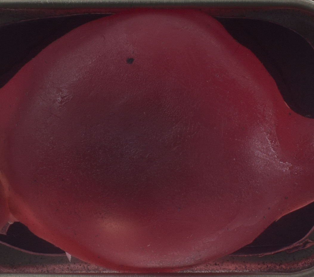 ovary